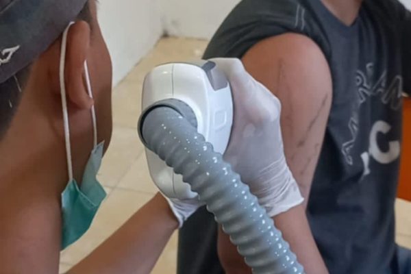 Rinas Rahman Specialist Hapus Tato Dengan Menggunakan Tehnik Laser Ikut Dalam Event Khitan Massal